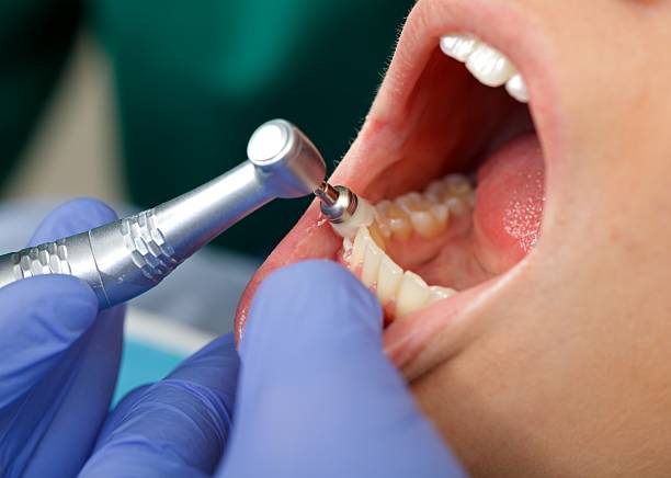 Best Periodontal (Gum) Disease Treatment  in Lacey, WA